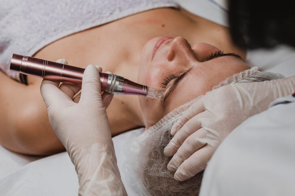 Microneedling for Skin Texture: How It Works, Benefits, and What to Expect