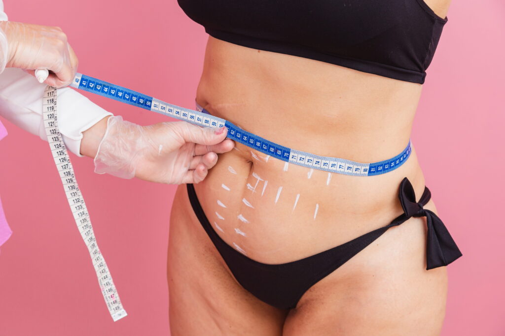 Liposuction vs Body Contouring: Which Is Right for You?